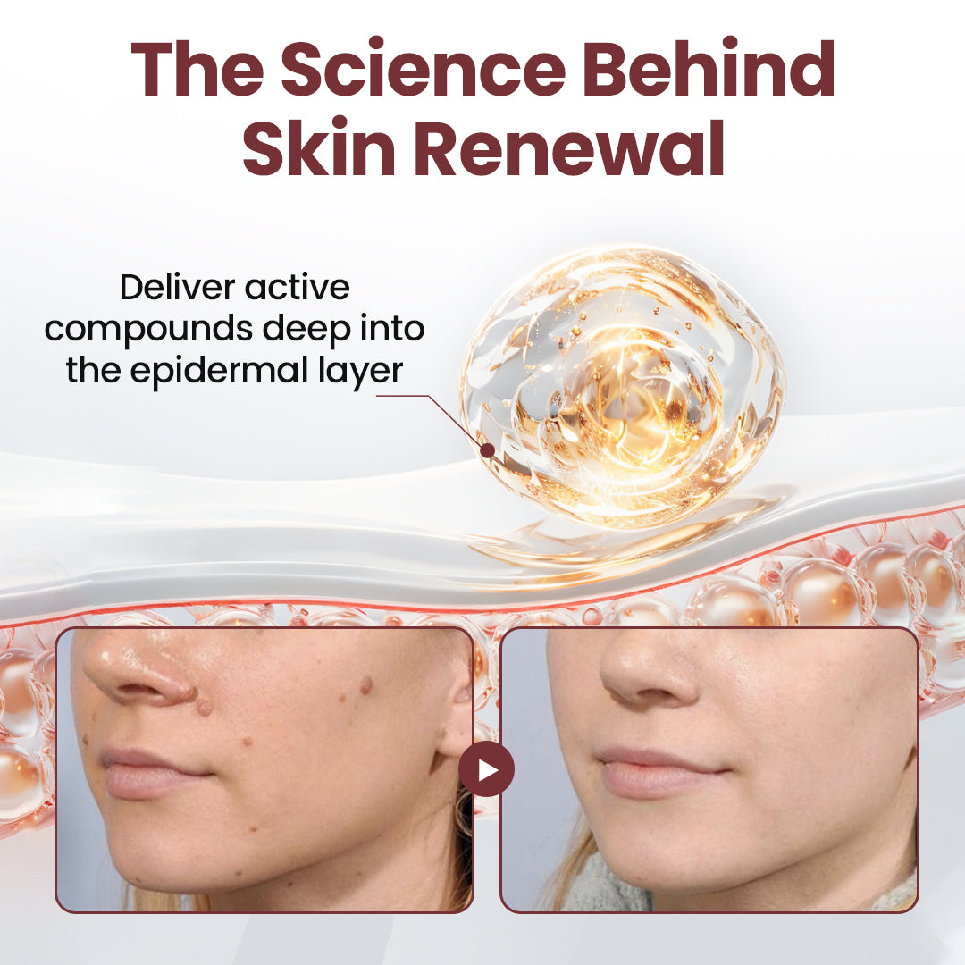 Seurico™KeraErase Dual-Action Renewal Cream 🔥