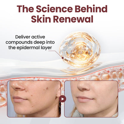 Seurico™KeraErase Dual-Action Renewal Cream 🔥
