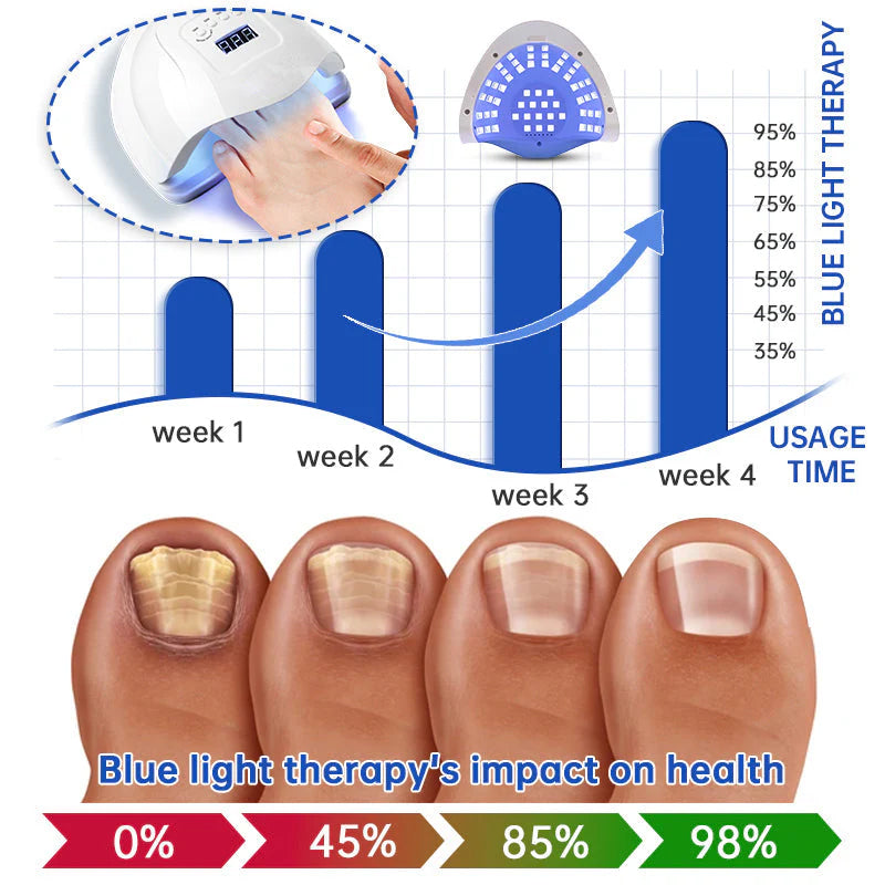ODEIUN  Fungus Laser Therapy Device