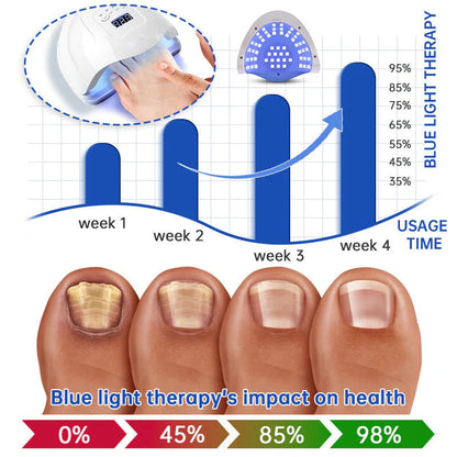 ODEIUN  Fungus Laser Therapy Device
