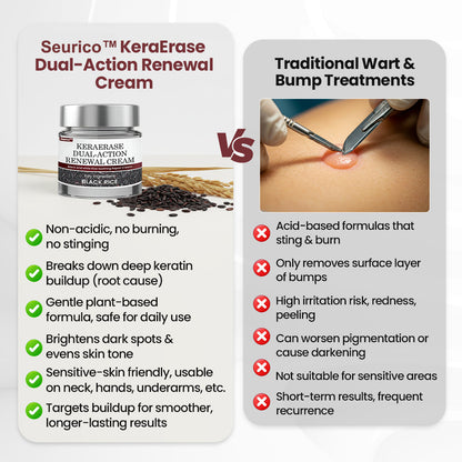 Seurico™KeraErase Dual-Action Renewal Cream 🔥