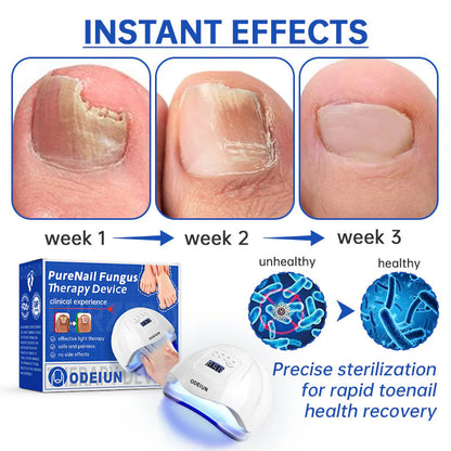 ODEIUN  Fungus Laser Therapy Device