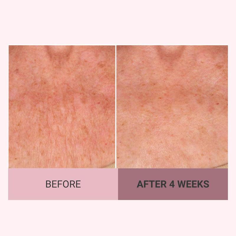 💆‍♀️ Experience Ultimate Luxury - 50% OFF - ✨ Champagne Beaute Lift Firming Body Cream - For Firmer, Smoother, Radiant Skin! 🌟（Buy 3 & Free Shipping）