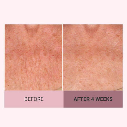 💆‍♀️ Experience Ultimate Luxury - 50% OFF - ✨ Champagne Beaute Lift Firming Body Cream - For Firmer, Smoother, Radiant Skin! 🌟（Buy 3 & Free Shipping）