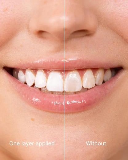 Seurico™ Tooth Polish