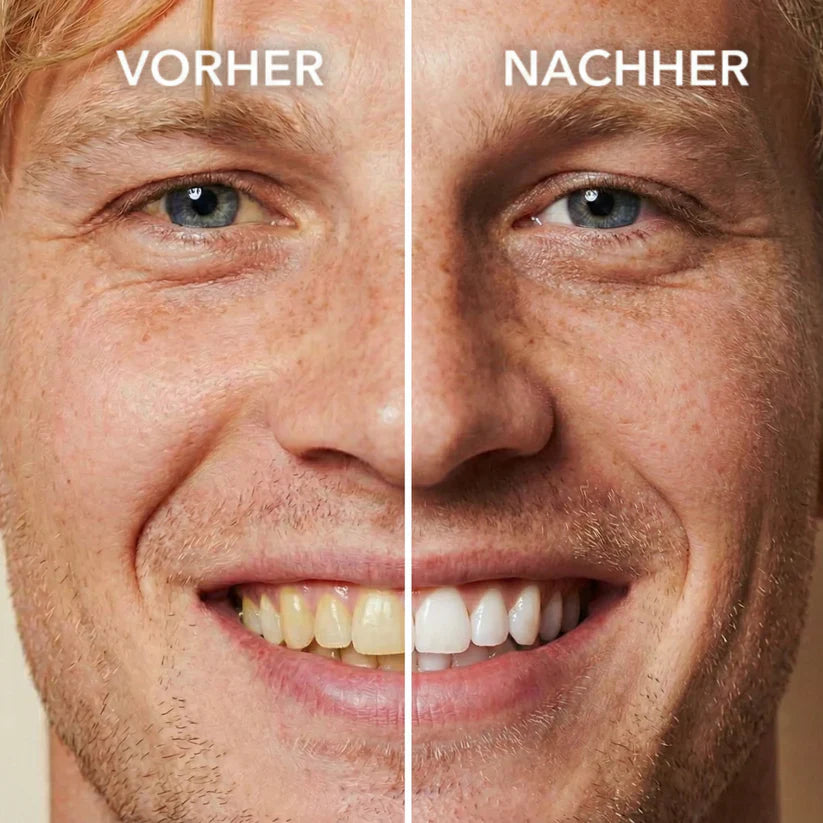 Seurico™ Tooth Polish