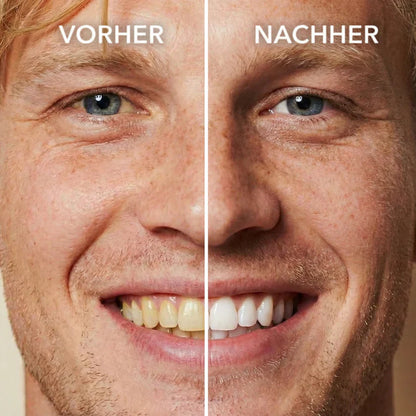 Seurico™ Tooth Polish