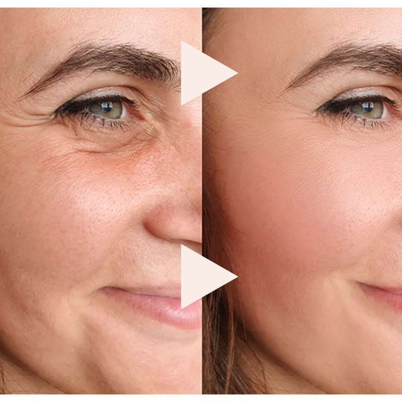 Final 3 Hours: 70% OFF🔥The Express Anti-Wrinkle – Instant Lifting Effect