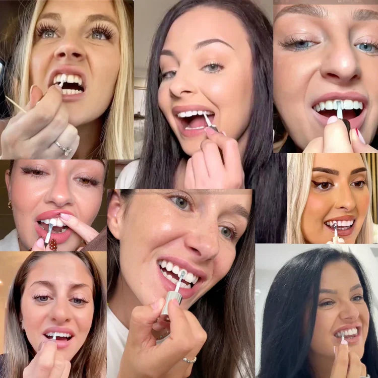 Seurico™ Tooth Polish