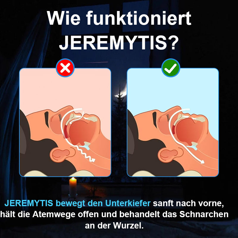 JEREMYTIS™ Adjustable Anti-Snoring Mouthpiece