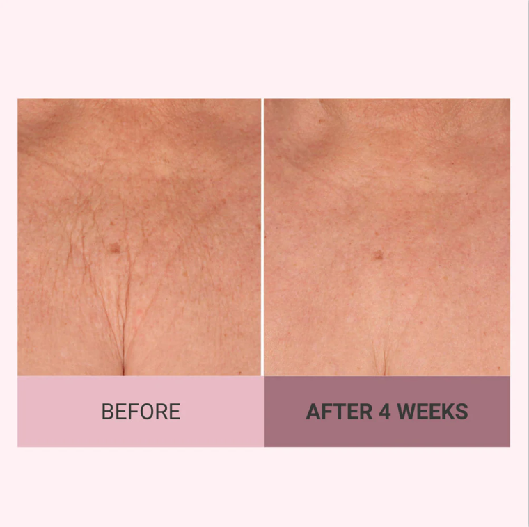 💆‍♀️ Experience Ultimate Luxury - 50% OFF - ✨ Champagne Beaute Lift Firming Body Cream - For Firmer, Smoother, Radiant Skin! 🌟（Buy 3 & Free Shipping）