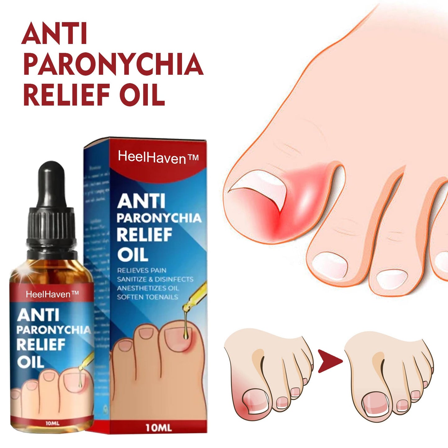 HEELHAVEN™ Anti Paronychia Relief Oil